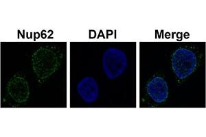 Sample Type :  Hela cell lysate