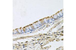 Immunohistochemistry of paraffin-embedded human lung using HSP90AA1 antibody (ABIN6292998) at dilution of 1:100 (40x lens).