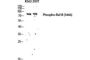 Western Blot (WB) analysis of K562 293T lysis using Phospho-Raf-B (S446) antibody. (BRAF antibody  (pSer446))