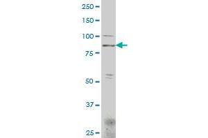 HOOK1 polyclonal antibody (A01), Lot # 060509JCS1 Western Blot analysis of HOOK1 expression in SJCRH30 . (HOOK1 antibody  (AA 632-728))