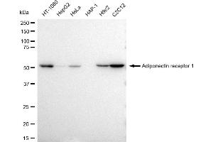Western blotting analysis using Adiponectin receptor 1 antibody (ABIN7797529).