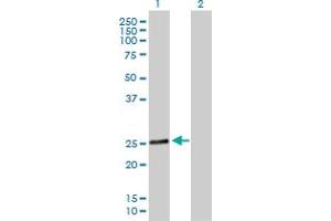 Western Blot analysis of RAB28 expression in transfected 293T cell line by RAB28 MaxPab polyclonal antibody. (RAB28 antibody  (AA 1-221))