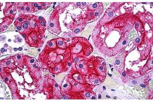 Human Kidney, Tubules: Formalin-Fixed, Paraffin-Embedded (FFPE) (GGT1 antibody  (AA 381-471))