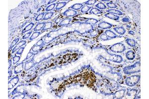 Immunohistochemistry (IHC) image for anti-Dihydroorotate Dehydrogenase (DHODH) (AA 132-173), (N-Term) antibody (ABIN4886562)