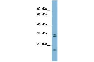 WB Suggested Anti-ANAPC10 Antibody Titration:  0. (ANAPC10 antibody  (N-Term))
