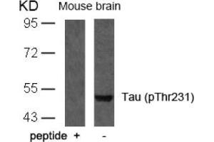 Image no. 1 for anti-Microtubule-Associated Protein tau (MAPT) (pThr231) antibody (ABIN196807) (MAPT antibody  (pThr231))