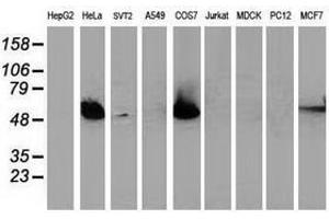 Image no. 2 for anti-Tumor Protein P53 (TP53) antibody (ABIN1499975) (p53 antibody)