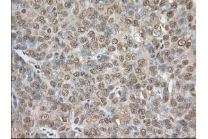 Immunohistochemical staining of paraffin-embedded Human colon tissue using anti-PDE4A mouse monoclonal antibody. (PDE4A antibody)