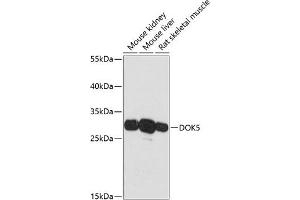 Western blot analysis of extracts of various cell lines, using DOK5 antibody (ABIN6127774, ABIN6139769, ABIN6139770 and ABIN6217826) at 1:3000 dilution. (DOK5 antibody  (AA 237-306))