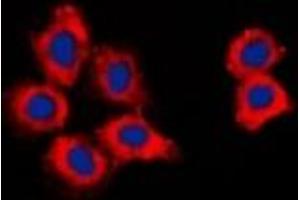Immunofluorescent analysis of CDK15 staining in HepG2 cells. (Cyclin-Dependent Kinase 15 (ALS2CR7) antibody)