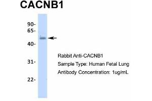 Host:  Rabbit  Target Name:  CACNB1  Sample Type:  Human Fetal Lung  Antibody Dilution:  1. (CACNB1 antibody  (N-Term))