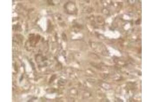 Image no. 1 for anti-BCL2 Binding Component 3 (BBC3) (AA 186-199) antibody (ABIN208703) (PUMA antibody  (AA 186-199))