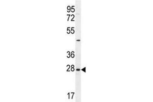 EDN3 antibody western blot analysis in NCI-H460 lysate (Endothelin 3 antibody  (AA 168-197))