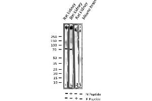 Western blot analysis of Phospho-C-RAF (Ser259) expression in various lysates (RAF1 antibody  (pSer259))