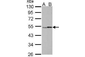 Retinoic Acid Receptor gamma antibody