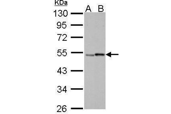 Retinoic Acid Receptor gamma antibody