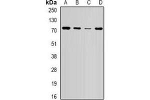 Western blot analysis of NSD2 expression in HepG2 (A), SW620 (B), mouse brain (C), mouse spleen (D) whole cell lysates. (WHSC1 antibody)