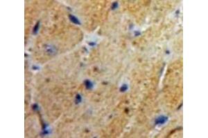 Used in DAB staining on fromalin fixed paraffin-embedded Heart tissue (MSE antibody  (AA 3-434))
