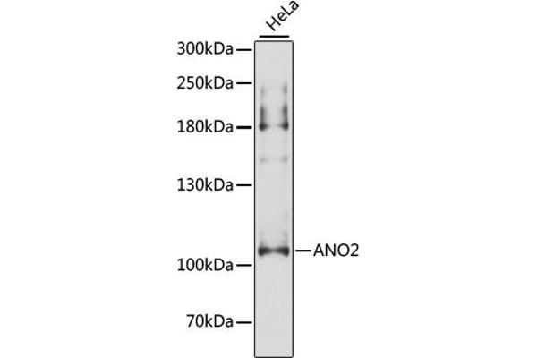 Anoctamin 2 antibody  (AA 1-200)