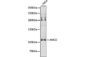 Western blot analysis of extracts of HeLa cells, using  antibody (ABIN6129704, ABIN6136903, ABIN6136905 and ABIN6216979) at 1:3000 dilution.