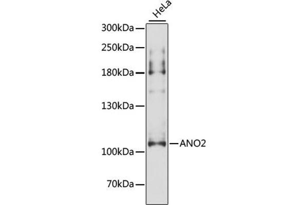Anoctamin 2 抗体  (AA 1-200)