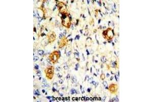 Immunohistochemistry (IHC) image for anti-Matrix Metallopeptidase 19 (MMP19) antibody (ABIN3002548) (MMP19 antibody)