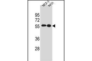 SRC Antibody (N-term) A western blot analysis in MCF-7,A431 cell line lysates (35 μg/lane). (Src antibody  (N-Term))
