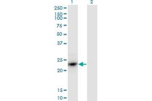 Western Blot analysis of HDGFRP3 expression in transfected 293T cell line by HDGFRP3 monoclonal antibody (M02), clone 1D1. (HDGFRP3 antibody  (AA 1-203))