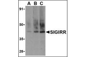 Western blot analysis of SIGIRR in A549 cell lysate with this product at (A) 0. (SIGIRR antibody  (C-Term))