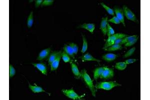 Immunofluorescent analysis of Hela cells using ABIN7165899 at dilution of 1:100 and Alexa Fluor 488-congugated AffiniPure Goat Anti-Rabbit IgG(H+L) (OS9 antibody  (AA 232-413))