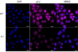 anti-5-Aminoimidazole-4-Carboxamide Ribonucleotide Formyltransferase/IMP Cyclohydrolase (ATIC) antibody