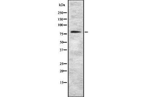 Western blot analysis of MTF1 using Jurkat whole cell lysates (MTF1 antibody  (Internal Region))