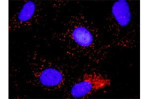 Proximity Ligation Assay (PLA) image for anti-Minichromosome Maintenance Complex Component 7 (MCM7) (AA 1-389) antibody (ABIN561764)