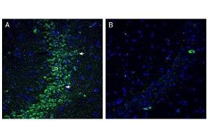 Expression of SLC19A1 in rat hippocampus. (SLC19A1 antibody  (6th Cytoplasmic Loop))