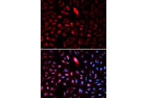 Immunofluorescence analysis of U2OS cells using TCP1 antibody (ABIN5971010). (TCP1 alpha/CCTA antibody)