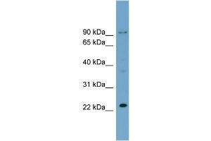 WB Suggested Anti-C15orf15  Antibody Titration: 0. (RSL24D1 antibody  (Middle Region))