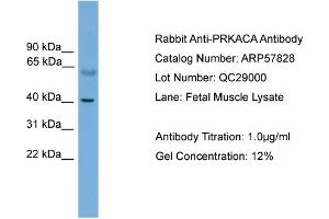 WB Suggested Anti-PRKACA  Antibody Titration: 0. (PRKACA antibody  (N-Term))