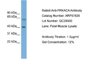 Western Blotting (WB) image for anti-Protein Kinase A, alpha (PRKACA) (N-Term) antibody (ABIN2787416)
