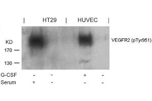 Western blot analysis of extracts from G-CSF-treated HUVEC and serum-treated HT29 cells using VEGFR2(Phospho-Tyr951) Antibody. (VEGFR2/CD309 antibody  (pTyr951))