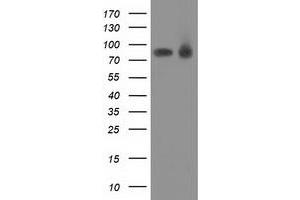Western Blotting (WB) image for anti-Protein Kinase C, epsilon (PRKCE) antibody (ABIN1500230)