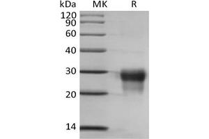 Western Blotting (WB) image for Placenta Growth Factor (PGF) protein (His tag) (ABIN7319842) (PLGF Protein (His tag))