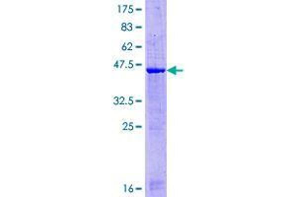 GATC Protein (AA 1-136) (GST tag)