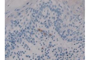 Immunohistochemistry (IHC) image for anti-Hypoxia Inducible Factor 1, alpha Subunit Inhibitor (HIF1AN) (AA 31-349) antibody (ABIN7441979)