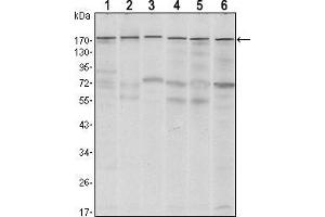 Western blot analysis using SETDB1 mouse mAb against MCF-7 (1),T47D (2), HEK293 (3), JURKAT (4), NIH/3T3 (5) and F9 (6) cell lysate. (SETDB1 antibody)
