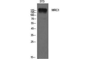 Western Blot analysis of NIH-3T3 cells with CD206 Polyclonal Antibody. (Macrophage Mannose Receptor 1 antibody)