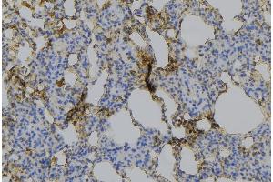 ABIN6275217 at 1/100 staining Mouse lung tissue by IHC-P. (Macrophage Mannose Receptor 1 antibody  (Internal Region))