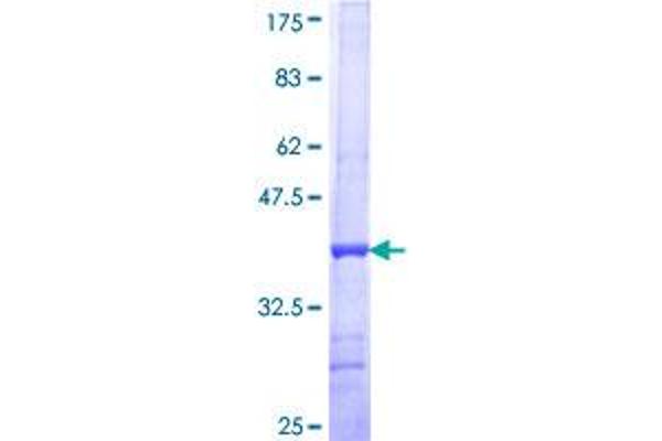 FUT2 Protein (AA 51-150) (GST tag)
