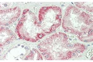 Detection of IFNb in Human Kidney Tissue using Polyclonal Antibody to Interferon Beta (IFNb) (IFNB1 antibody  (AA 22-187))