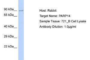 Host: Rabbit Target Name: PARP14 Sample Type: 721_B Whole Cell lysates Antibody Dilution: 1.