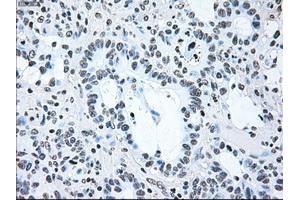 Image no. 2 for anti-B-Raf proto-oncogene, serine/threonine kinase (BRAF) antibody (ABIN1496961) (BRAF antibody)